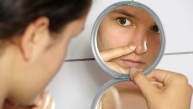 How To Remove Acne From Your Face